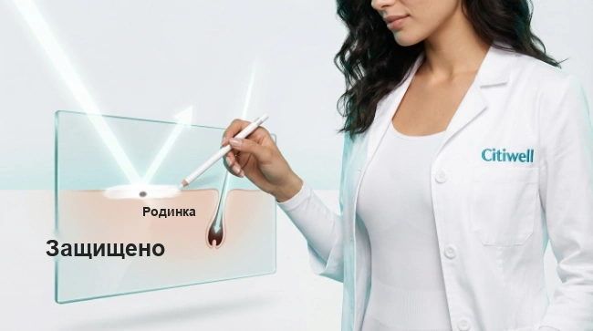 Защита родинок при эпиляции